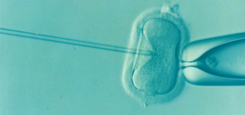 What is In-Vitro Fertilisation (IVF) and when to consider IVF?